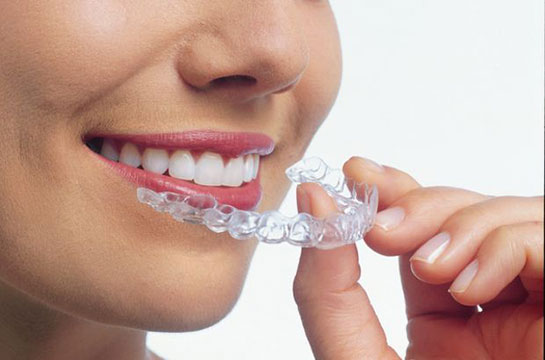 Diş Plağı Temizliği ve Kullanımı